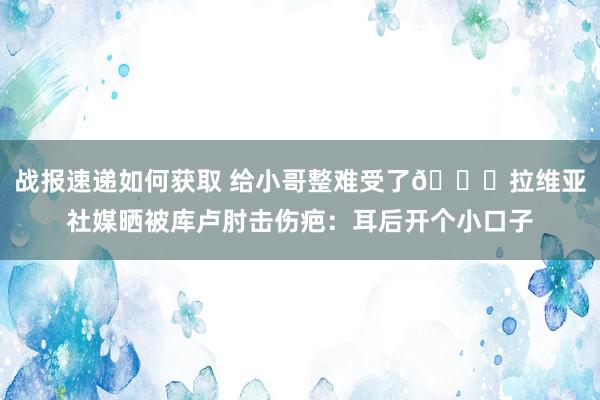 战报速递如何获取 给小哥整难受了😅拉维亚社媒晒被库卢肘击伤疤：耳后开个小口子